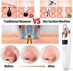 5-in-1 Blackhead Remover Machine