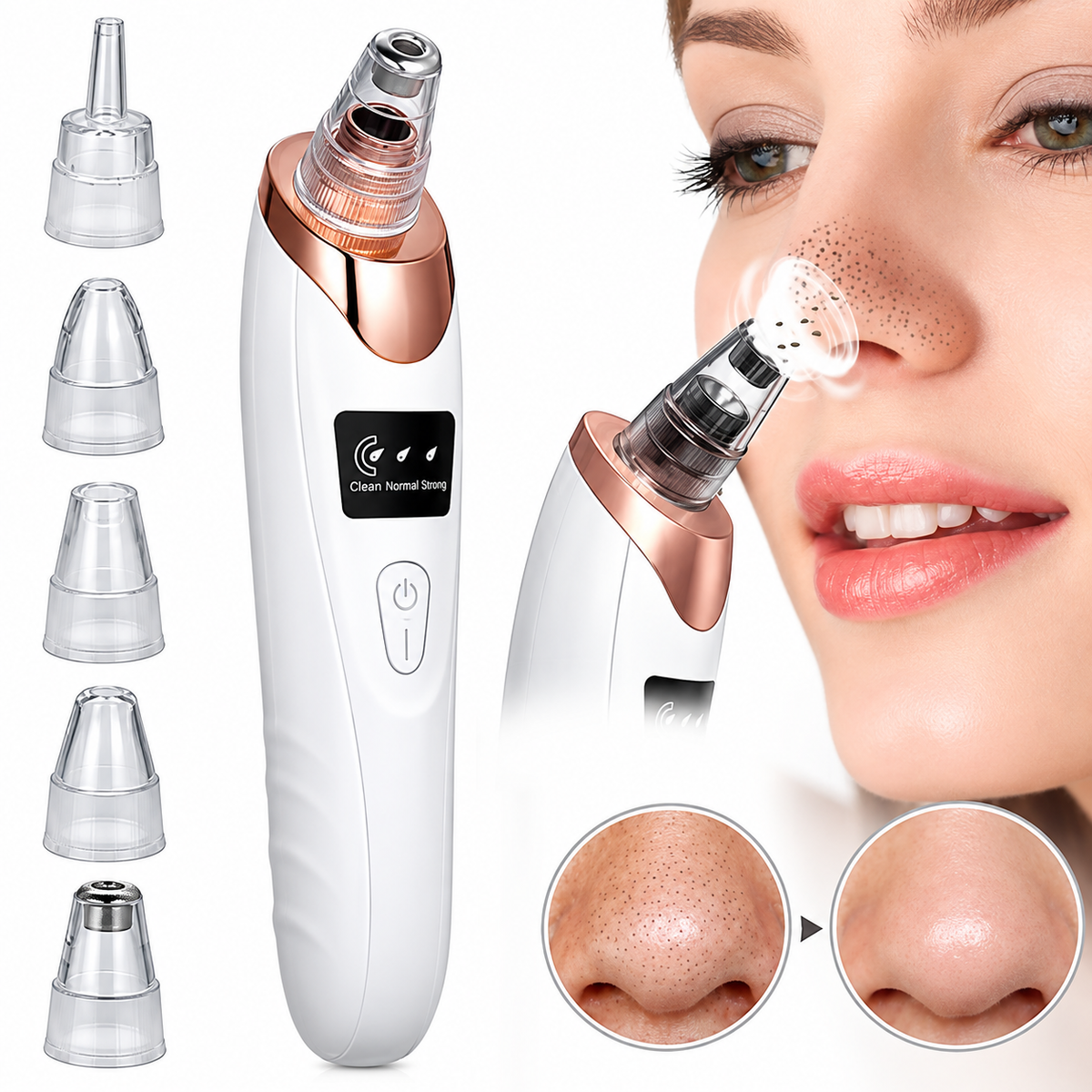 5-in-1 Blackhead Remover Machine